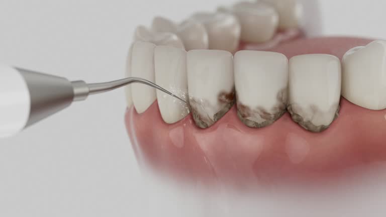 Reliable Tooth Extraction contractor in Healdsburg, CA by Smile Center Dentistry